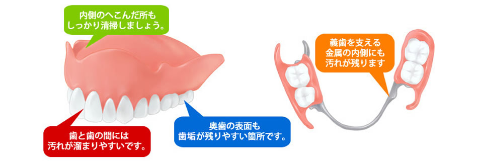 義歯（入れ歯）の清掃について